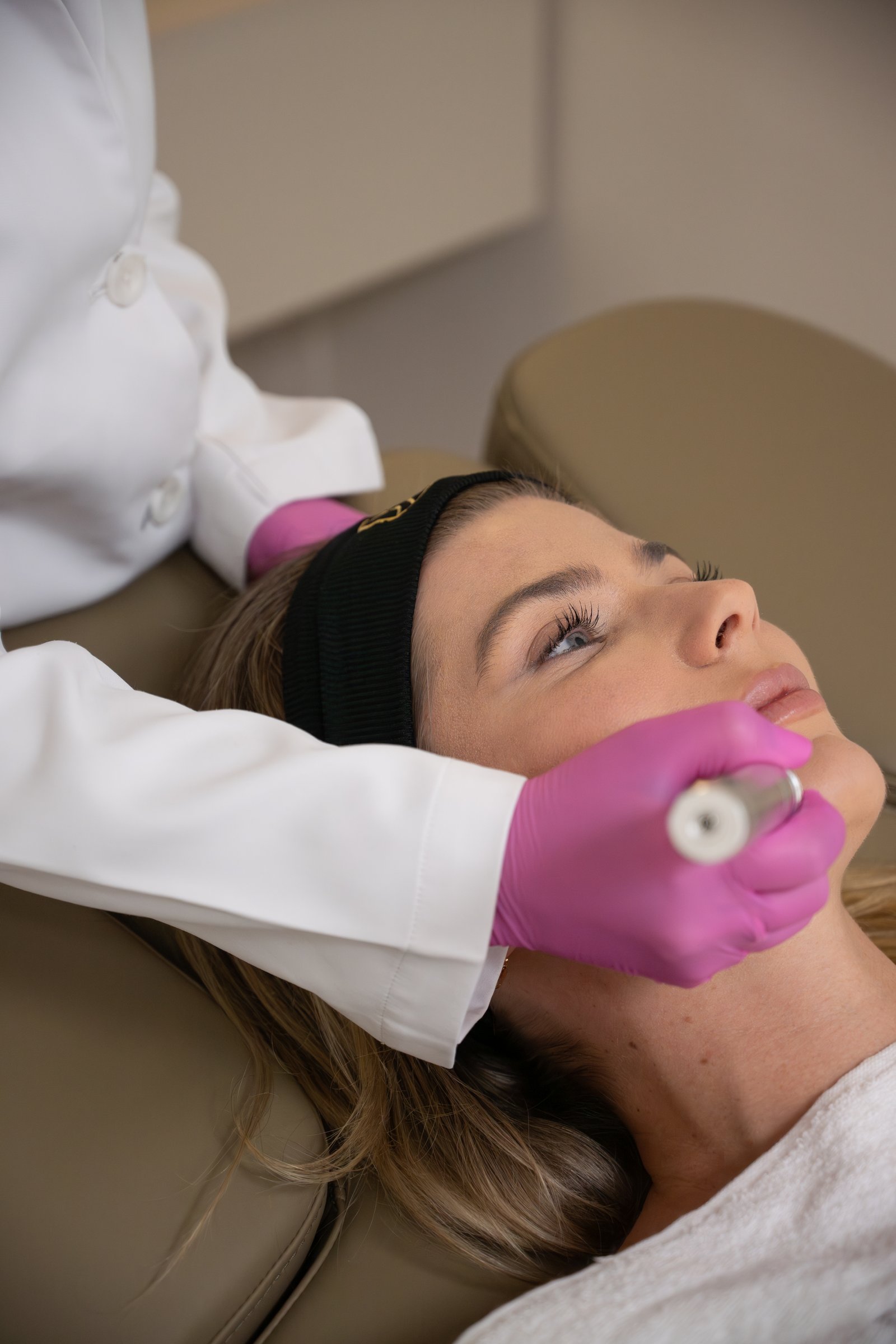 Peeling químico Madrid